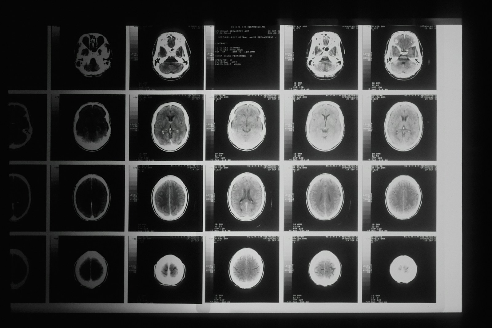AI-powered diagnostic imaging
